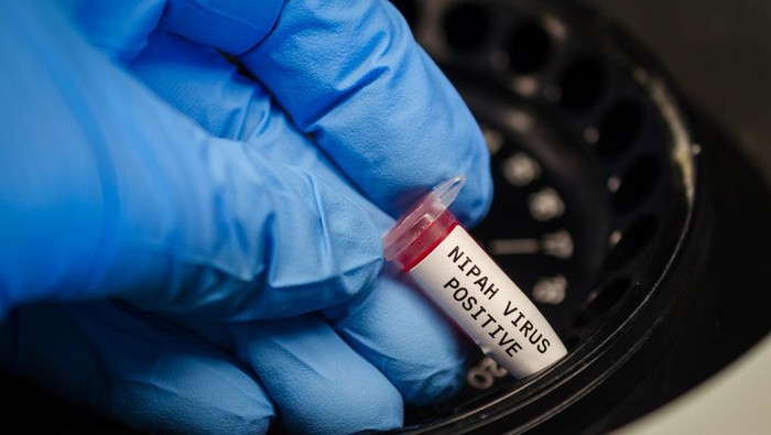CDC Taiwan Masukkan Virus Nipah Kategori 5, Indonesia Diminta Waspada