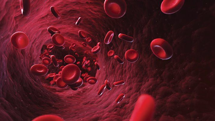 10 Penyebab Anemia yang Sering Tak Disadari