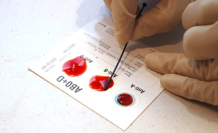 Golongan Darah B Berisiko Diabetes Tipe 2, Ini Fakta Penelitian Terbaru