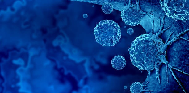 Teknologi Baru Bisa Deteksi Kanker Lebih Dini, Kenali PET CT dan SPECT CT Scan