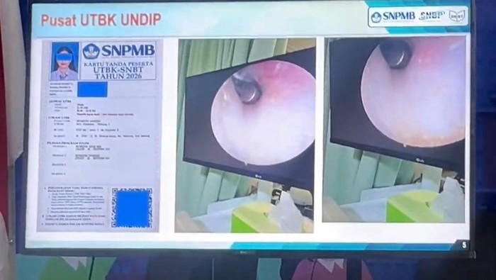 UTBK-SNBT 2026 Diwarnai Kecurangan, Peserta Gunakan Joki hingga Alat di Telinga
