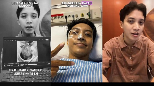 Kisah Pria Surabaya Kena Kanker Ginjal di Usia 35, Awalnya Hanya Nyeri Perut hingga Harus Angkat Ginjal